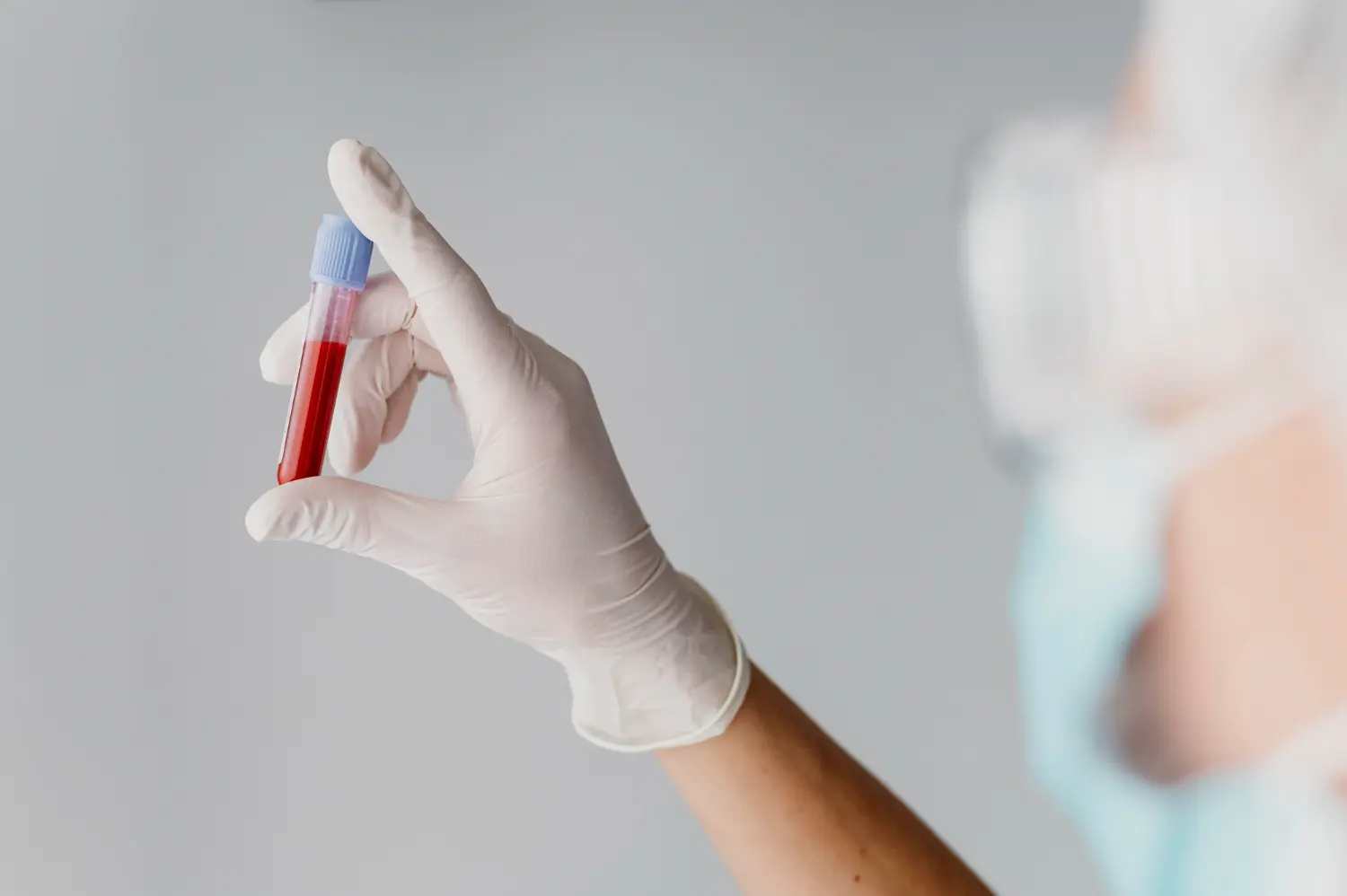 Analiză de sânge detectează boala Crohn cu zece ani înainte de diagnostic