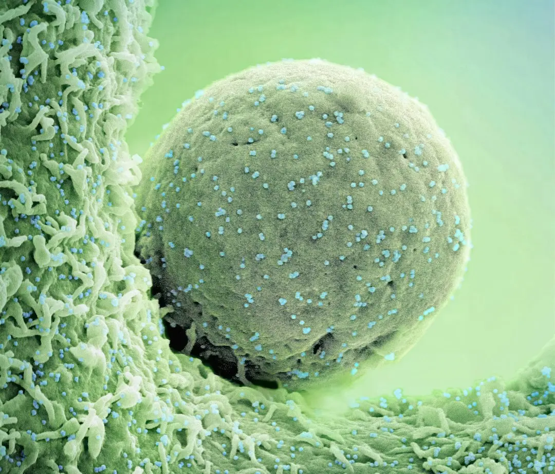 Bătrânețe biologică accelerată crescă riscul de cancer colorectal la vârstă tinere în studiul coreean