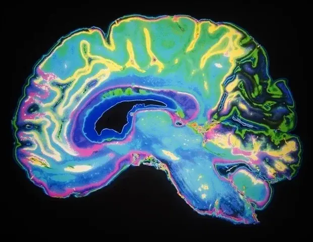 O nouă teorie leagă tulburările cerebrale cronice printr-un mecanism comun