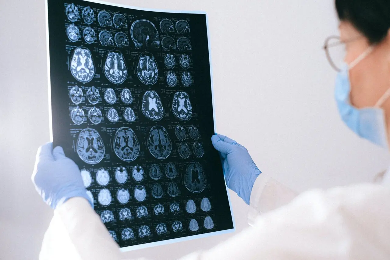 Testarea ADN-ului din lichidul cefalospinal clarifică diagnosticul tumorilor cerebrale