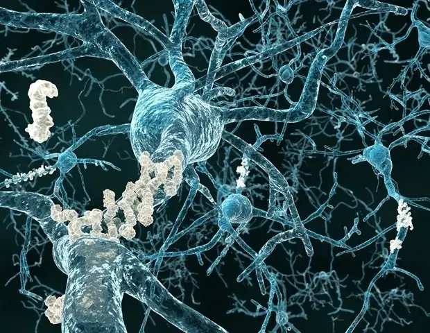 UC San Diego se alătură luptei naționale împotriva bolii Alzheimer